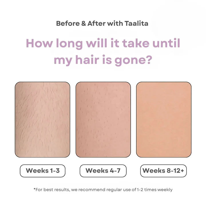 NUROA ™ IPL Hair Remover | Hair-Free Skin in Just Weeks