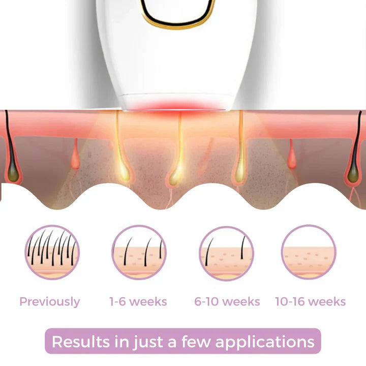 NUROA ™ IPL Hair Remover | Hair-Free Skin in Just Weeks